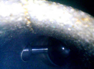 利用HIE系列內(nèi)窺鏡檢測到的某4s店發(fā)動機(jī)進(jìn)氣道圖片