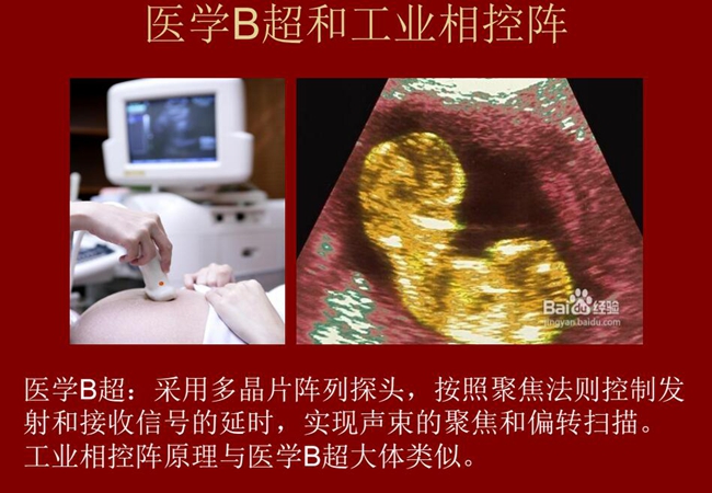 工業(yè)相控陣原理與醫(yī)學(xué)B超大體類似,醫(yī)學(xué)B超采用多晶片陣列探頭,按照聚焦法則控制發(fā)射和接收信號(hào)的延時(shí),實(shí)現(xiàn)聲束的聚焦和偏轉(zhuǎn)掃描